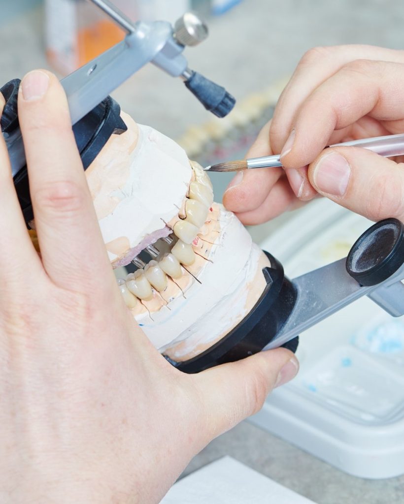 Excelencia de AV Dental